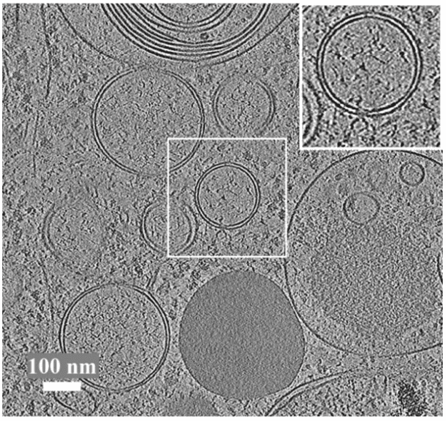 Example of an AreTomo2 reconstructed tomogram, showcasing the capabilities of this automated alignment and reconstruction software.